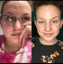 Load image into Gallery viewer, Turmeric Glass Skin Bundle